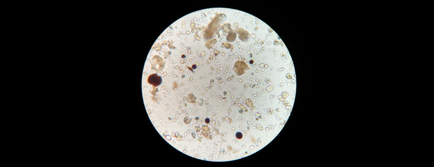 Amniotic-membrane_1740x670.png