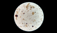 Amniotic-membrane_800x470.png