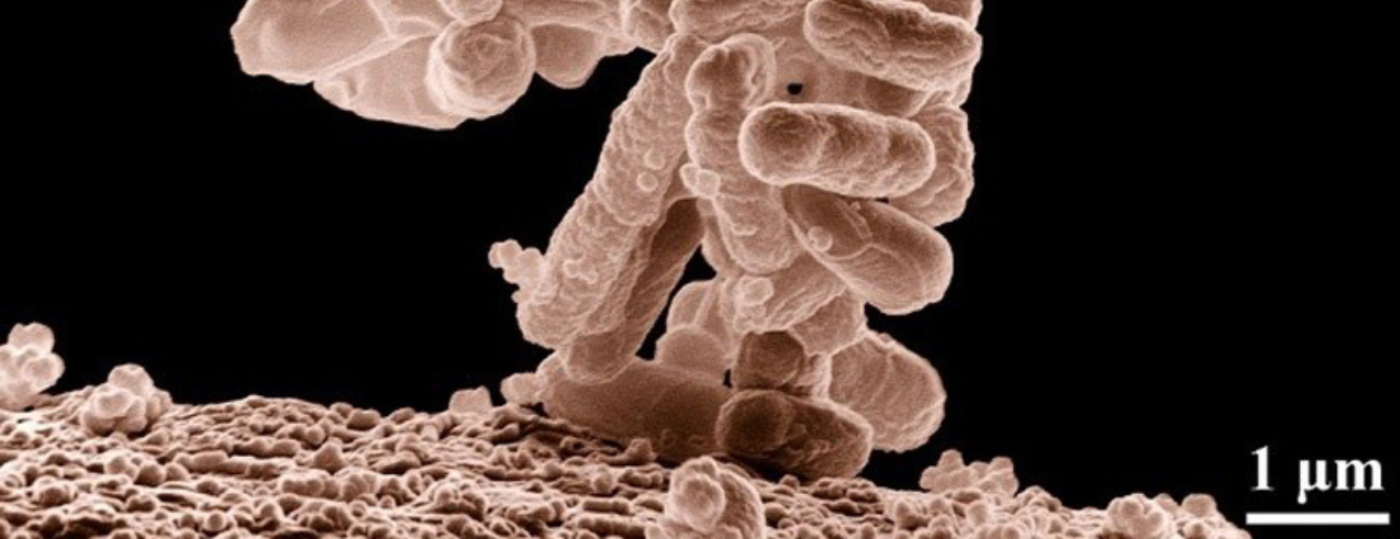Antibiofilm-method_1740x670.png