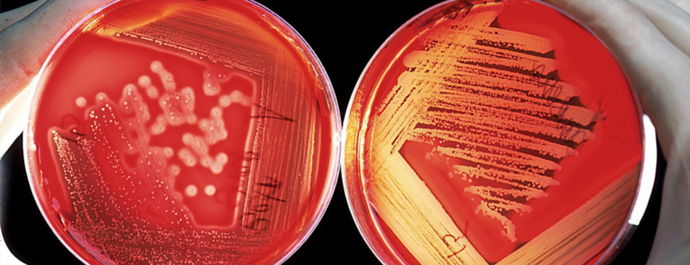 TT-Novel-antibacterials_1740x670.png